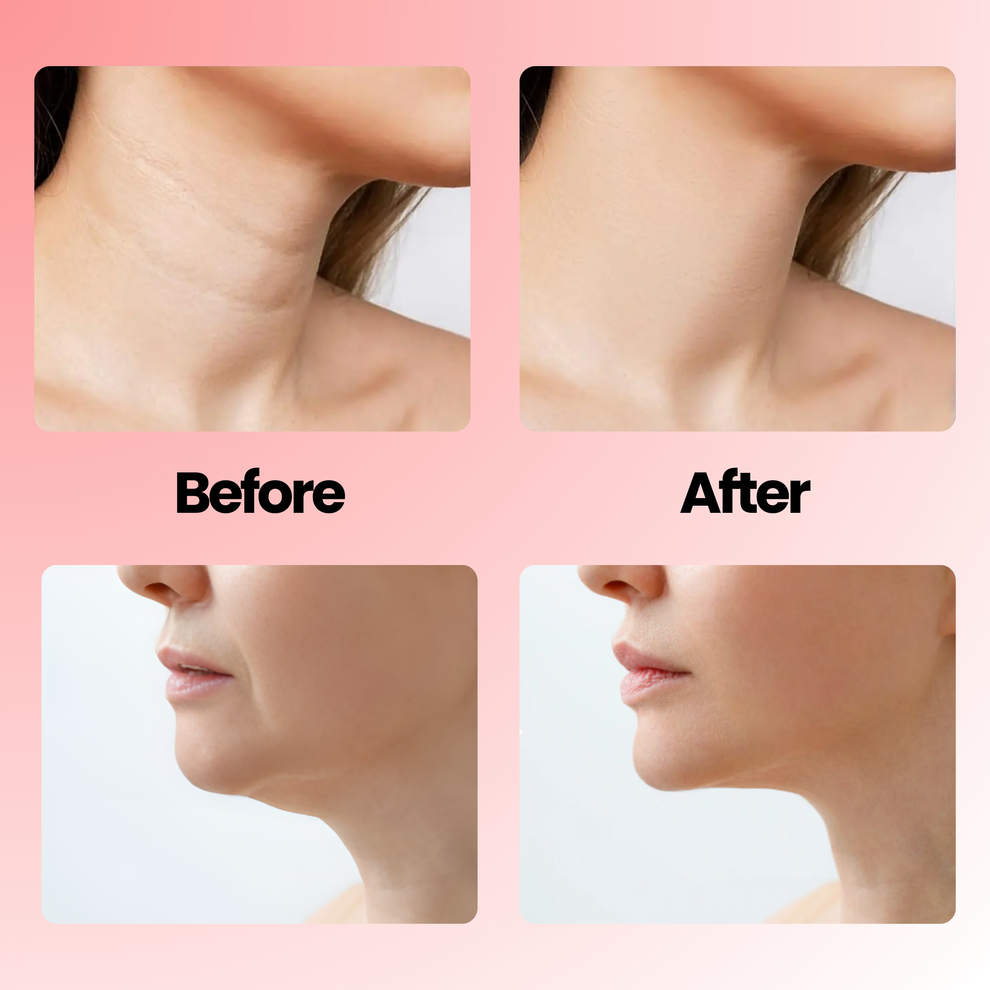 Sorose 7 in 1 EMS LED Facial Sculptor